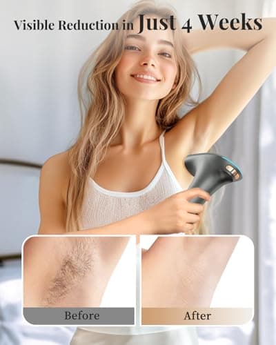 Haarlosy IPL Laser Hair Removal Device 3-in-1, 9 Levels, 999,900 Flashes, Auto Mode - Dark Grey - Image 10