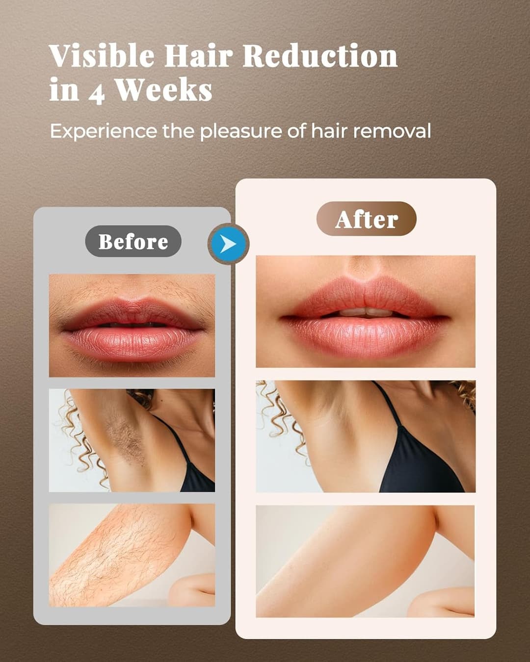 Haarlosy IPL Laser Hair Removal Device 3-in-1, 9 Levels, 999,900 Flashes, Auto Mode - White Gold - Image 2