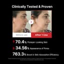 Medicube AGE-R Booster Pro 6-in-1 LED Skincare Device thumbnail 5