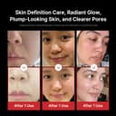 Medicube AGE-R Booster Pro 6-in-1 LED Skincare Device thumbnail 4
